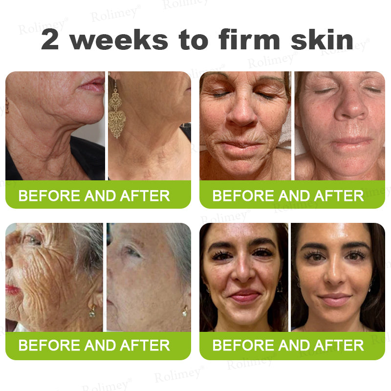 👏🌿Proudly Made in the UK💫Rolimey® Botox & Vita-A Retinol Shot Wrinkle-Lift Tightening cream - Last Day Promotion 70% OFF⏰⏰