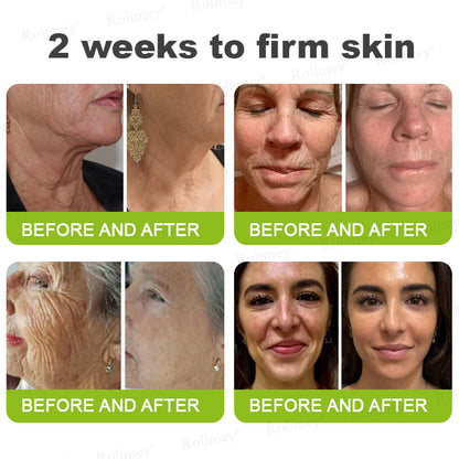 👏🌿Proudly Made in the UK💫Rolimey® Botox & Vita-A Retinol Shot Wrinkle-Lift Tightening cream - Last Day Promotion 70% OFF⏰⏰