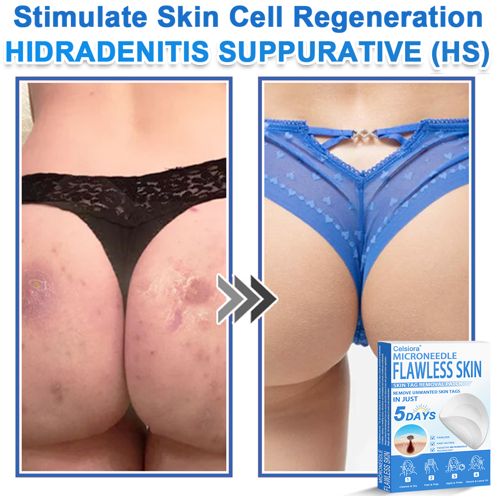 Celsiora®✅2-in-1 Microneedle & Hydrocolloid Patch | Raised Moles,Acne,  Flat Warts & Skin Tags Remover | Improves Wrinkles, Scars & Blemishes | Invisible Pimple Patches for Face & Body