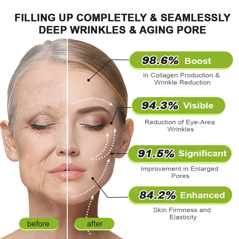 👏🌿Proudly Made in the UK💫Rolimey® Botox & Vita-A Retinol Shot Wrinkle-Lift Tightening cream - Last Day Promotion 70% OFF⏰⏰