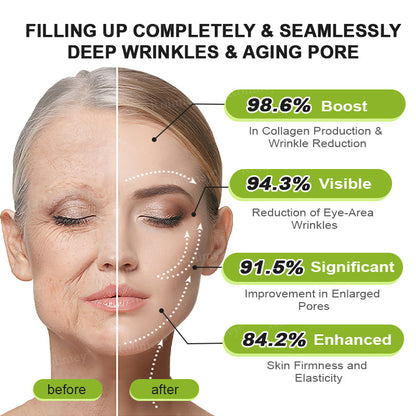 👏🌿Proudly Made in the UK💫Rolimey® Botox & Vita-A Retinol Shot Wrinkle-Lift Tightening cream - Last Day Promotion 70% OFF⏰⏰