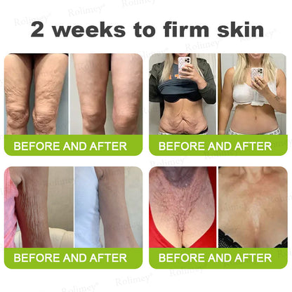 👏🌿Proudly Made in the UK💫Rolimey® Botox & Vita-A Retinol Shot Wrinkle-Lift Tightening cream - Last Day Promotion 70% OFF⏰⏰