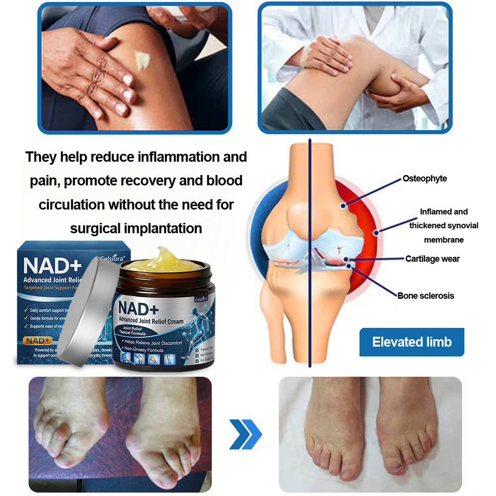 Celsiora® NAD+ Advanced Anti-Aging Joint Relief Cream (Ease Arthritis • Calm Nerve & Muscle Pain)