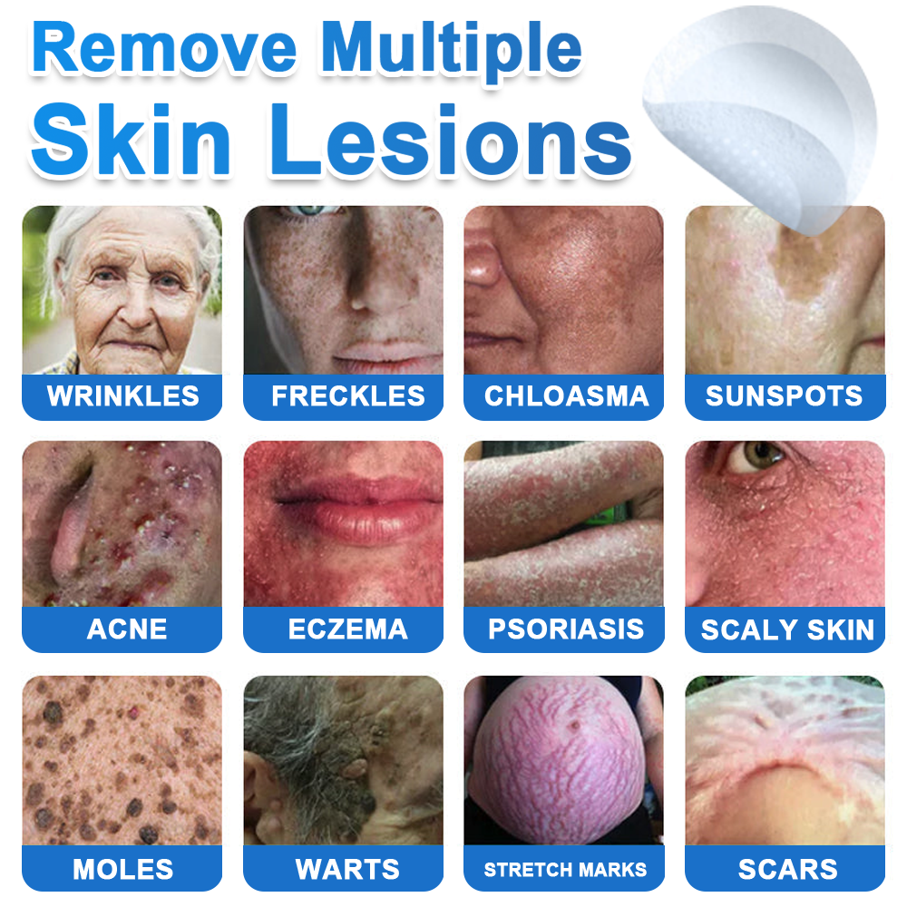 Celsiora®✅2-in-1 Microneedle & Hydrocolloid Patch | Raised Moles,Acne,  Flat Warts & Skin Tags Remover | Improves Wrinkles, Scars & Blemishes | Invisible Pimple Patches for Face & Body