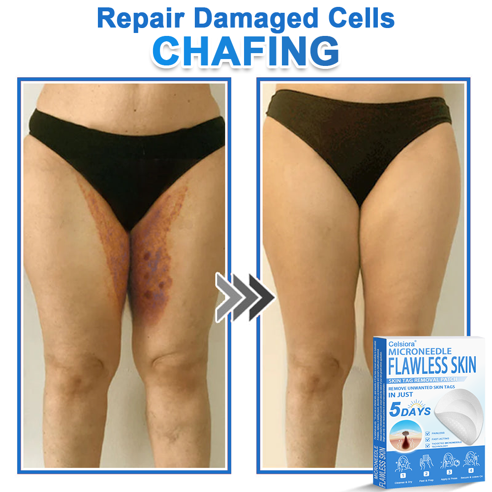 Celsiora®✅2-in-1 Microneedle & Hydrocolloid Patch | Raised Moles,Acne,  Flat Warts & Skin Tags Remover | Improves Wrinkles, Scars & Blemishes | Invisible Pimple Patches for Face & Body