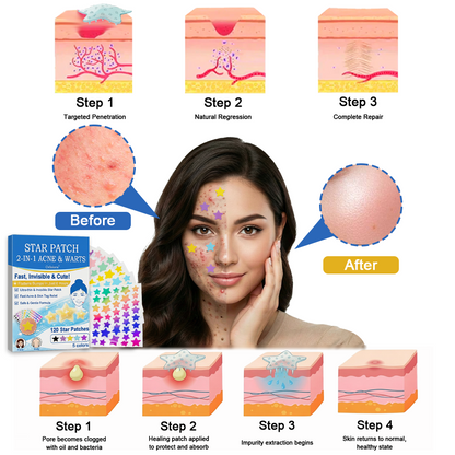 ✔ Celsiora® 2-in-1 Microneedle & Hydrocolloid Star Patch | Acne, Raised Moles, Flat Warts & Skin Tags Remover | 6 Colors Pimple Patch for Face & Neck | Invisible Star Zit Stickers | 240 Count