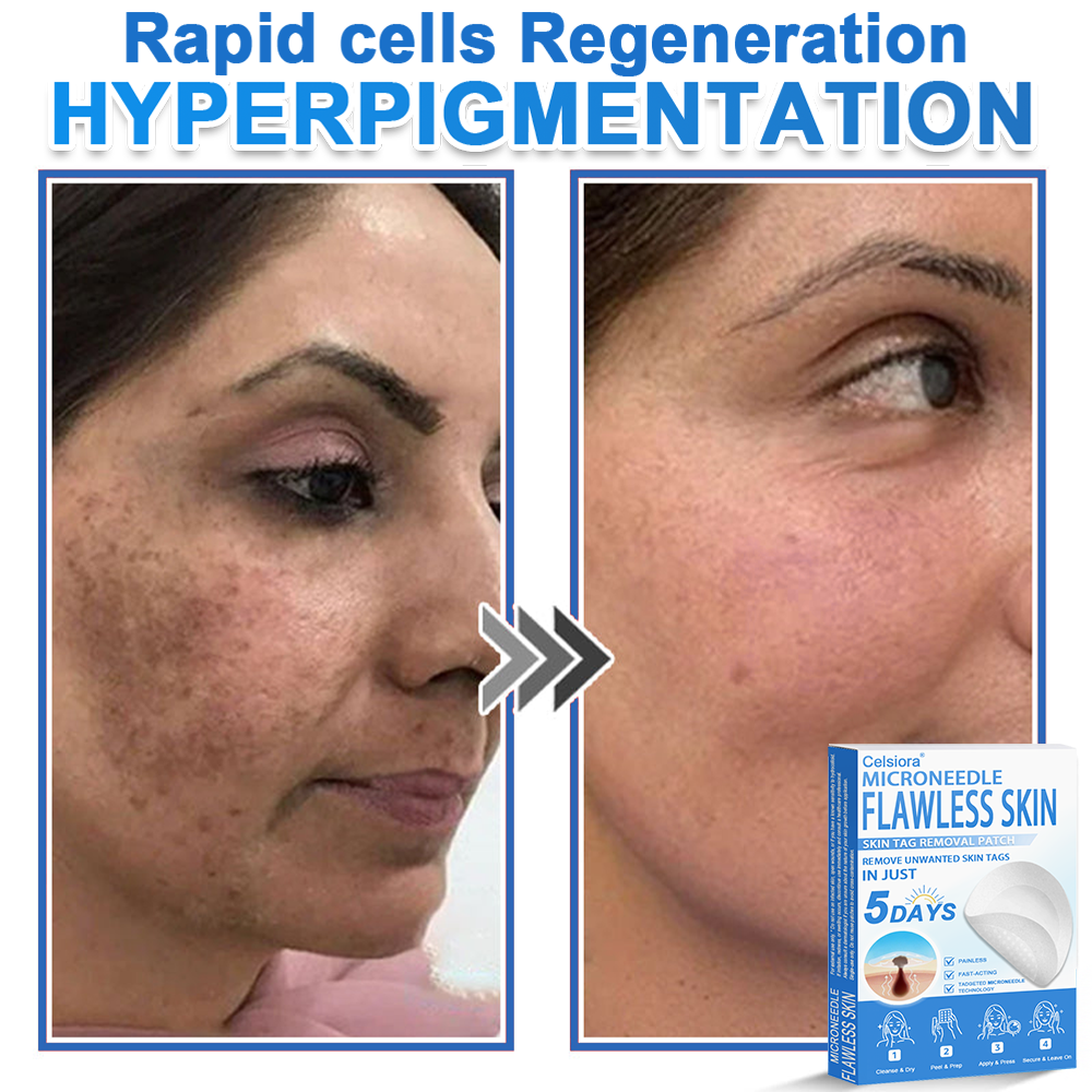 Celsiora®✅2-in-1 Microneedle & Hydrocolloid Patch | Raised Moles,Acne,  Flat Warts & Skin Tags Remover | Improves Wrinkles, Scars & Blemishes | Invisible Pimple Patches for Face & Body