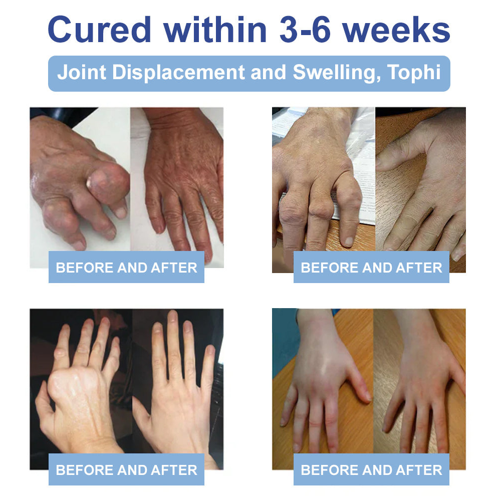✨Orthopedic Surgeon Endorsed | Anti-Aging Cellular Repair: Celsiora® NAD Advanced Joint Relief Cream (Treatment for Osteoarthritis, Rheumatoid Arthritis,Sports Injuries,  Compressed Nerves, and Chronic Muscle Strain)