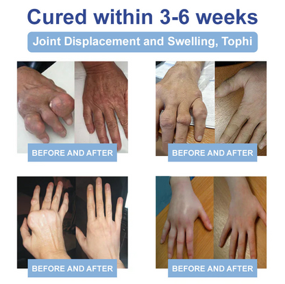 ✨Orthopedic Surgeon Endorsed | Anti-Aging Cellular Repair: Celsiora® NAD Advanced Joint Relief Cream (Treatment for Osteoarthritis, Rheumatoid Arthritis,Sports Injuries,  Compressed Nerves, and Chronic Muscle Strain)