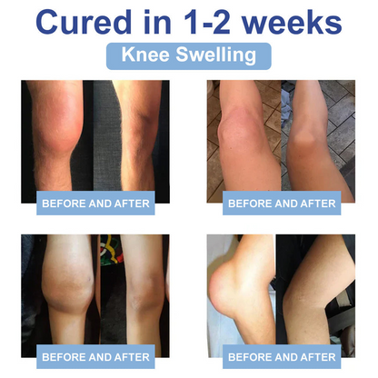 ✨Orthopedic Surgeon Endorsed | Anti-Aging Cellular Repair: Celsiora® NAD Advanced Joint Relief Cream (Treatment for Osteoarthritis, Rheumatoid Arthritis,Sports Injuries,  Compressed Nerves, and Chronic Muscle Strain)