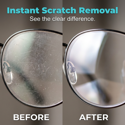 ⏰ Hot Sale🔥💥LAST DAY SALE 50%OFF💥 Lens Scratch Repair Spray 👓✨ – Micro-Scratch Remover, Streak-Free, Safe on Coatings