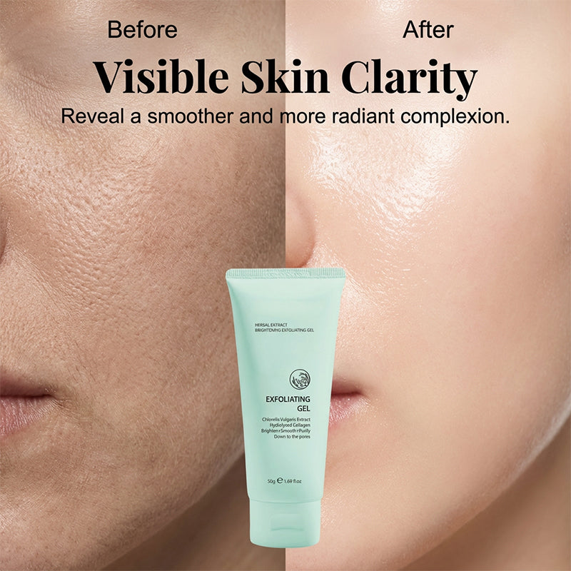 🥳2026 HOT SALE🥳💞50K+ SOLD!💥👵🌸 40% OFF!Herbal Extract Brightening Exfoliating Gel