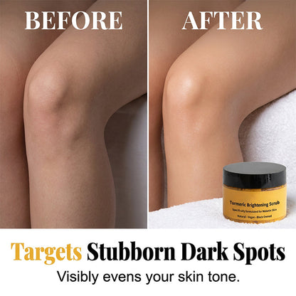 🥳🔥BUY 2 GET 1 FREE🔥Turmeric Exfoliating Body Scrub